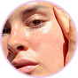 Radiant Complexion