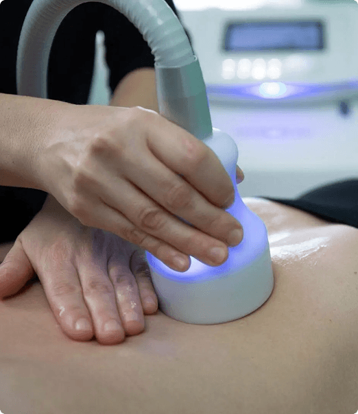 Cryoskin Toning