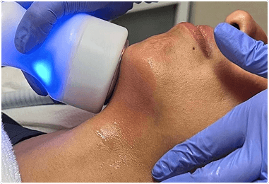 Revolutionary Treatment