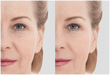Non-Invasive Solution