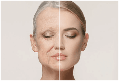 Wrinkle Reduction