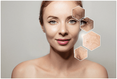 Anti-Aging
