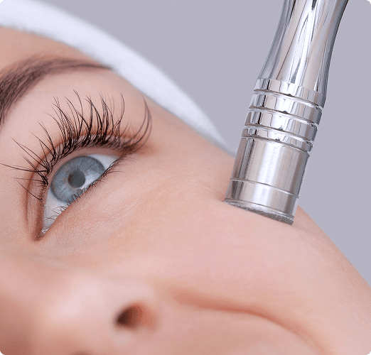 Microdermabrasion Treatment