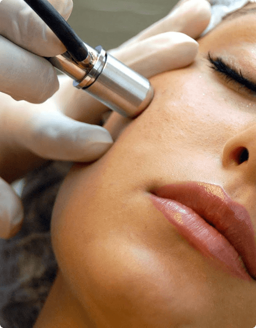 Microdermabrasion target skin concerns