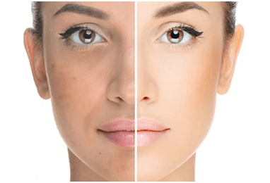 Reveal Undamaged Skin